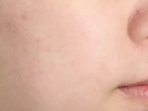 洗劫了编辑部后才发现，她们的面膜都这么好用