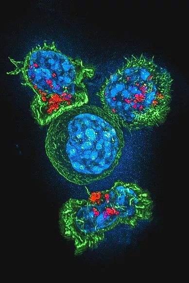 鍋囧鐥呮瘨鎰熸煋浜嗕綘,鍋囧鐥呮瘨鎰熸煋浜嗘垜