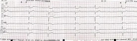 病例丨“一波三折”的三度房室传导阻滞，原因何在？