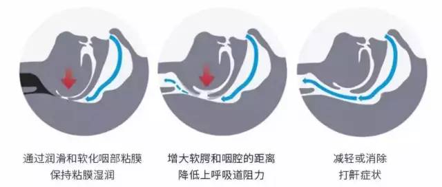 呼噜喷雾小孩能用吗,零到一岁的宝宝呼噜止鼾神器