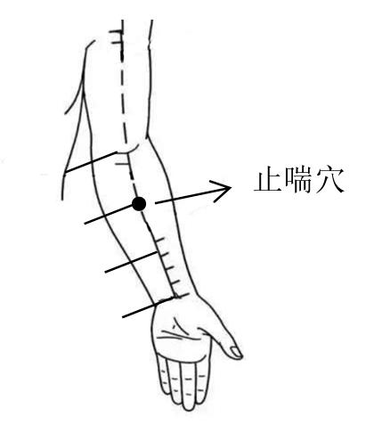 「临床心得」尽早解毒、尽早扶正、针药并用，雷神山医院C6病区的解毒“秘笈”
