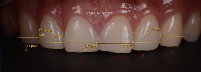 门牙中间有缝是否影响运势,门牙开缝是不是很丑