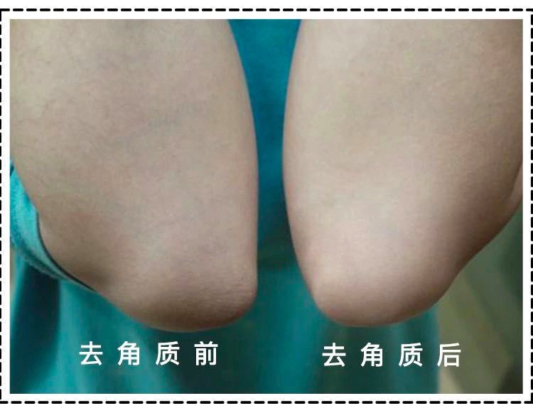 啪啪多了那里会变黑？90%的女生都被骗了