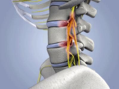 关节异响可以自愈嘛,关节咔咔响一招解决小妙招