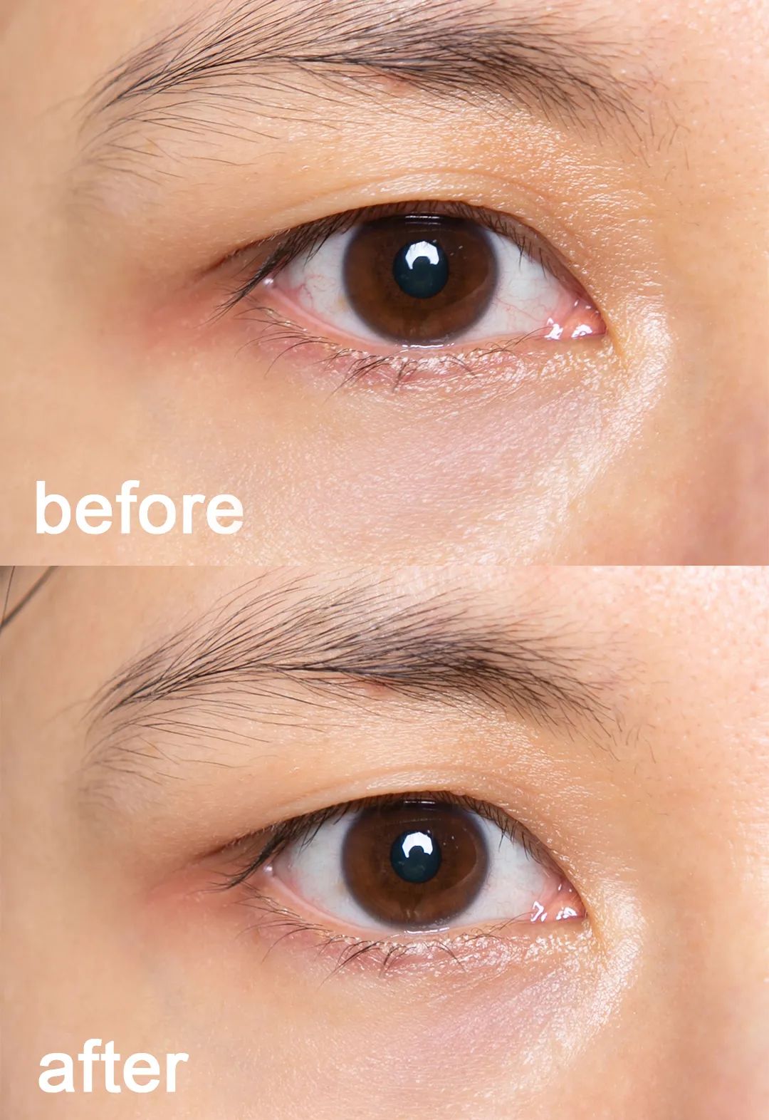 让眼睛变大最快的动作,让眼睛变大100倍