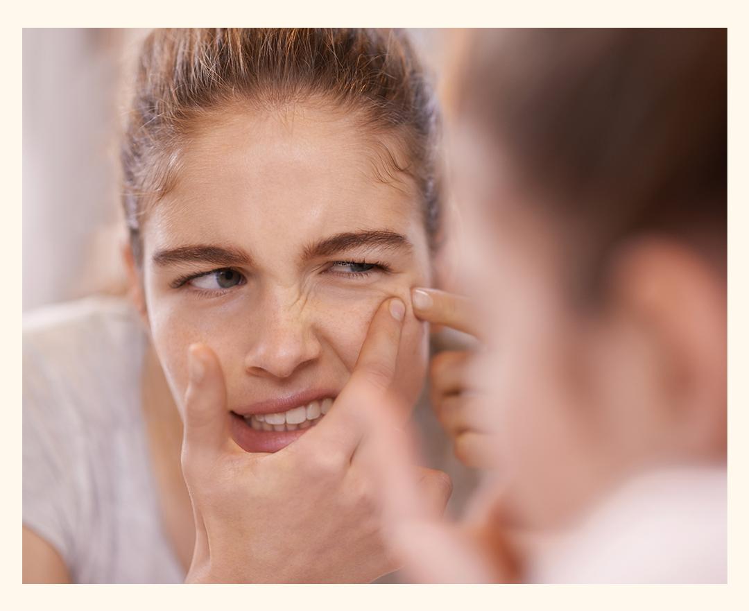 黑头痘印怎么去除,黑头痘印怎么消除学生党