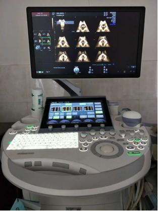 大笑咳嗽会流尿咋办,大笑咳嗽漏尿做什么手术