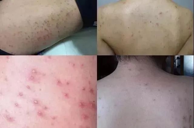 无痛搓泥|日系变态搓澡巾！轻轻搓一搓，泥条劈里啪啦的掉