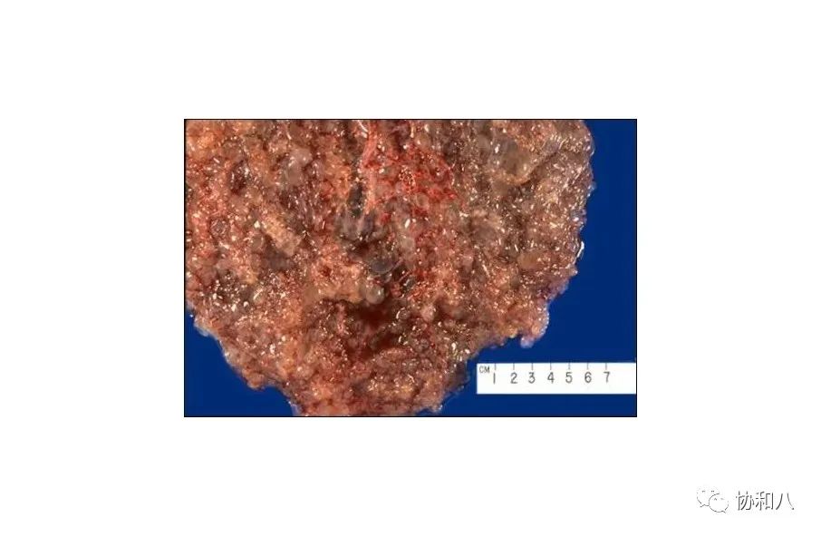 复习这些名解时总觉得怪饿的|协和八·脑洞大开