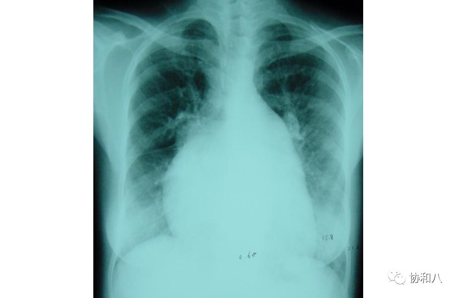 复习这些名解时总觉得怪饿的|协和八·脑洞大开