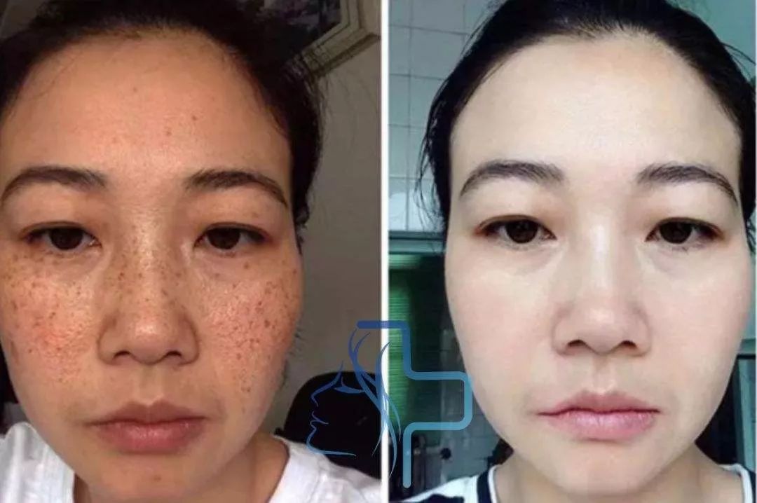 喝胶原蛋白要坚持多久才能有效果,紧急提醒经常喝这个的人要注意了