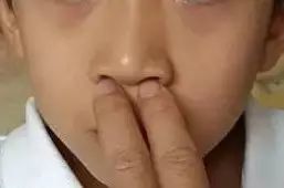 鼻炎流清水鼻涕鼻塞吃什么药,怀孕鼻炎犯了鼻塞睡不着怎么办