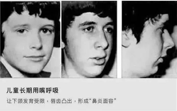 鼻炎太折磨人了怎么治呢,鼻炎折磨人吗