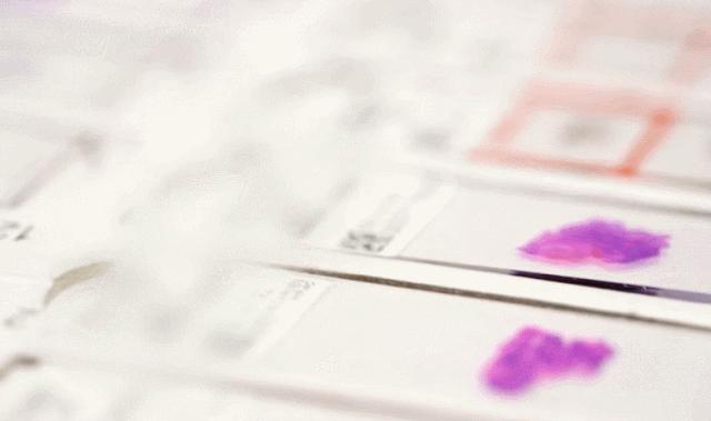 探秘病理科,病理科活检为什么慢