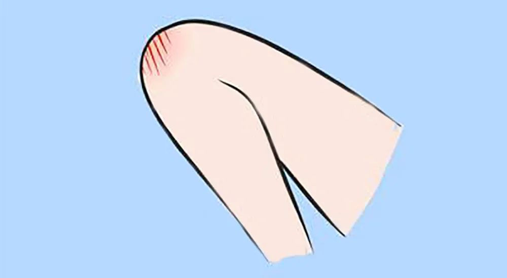 孩子掉床摔到头怎么处理,小孩掉床后如何处理