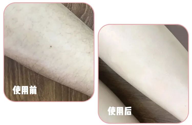 不含芦荟的脱毛膏,猕猴桃脱毛膏排行榜