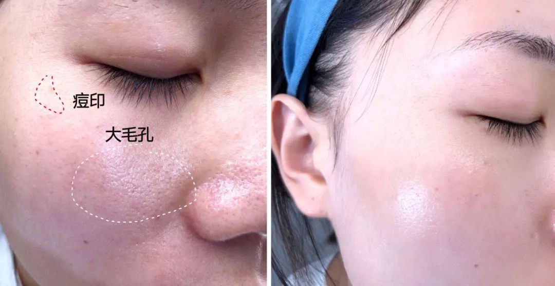 洗出脸上的脏东西解压,清除脸上斑块的产品