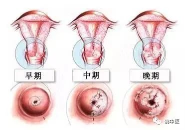 母亲节实用健康礼物,母亲节最好的礼物是健康