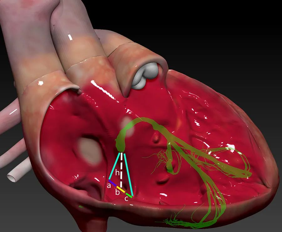 “绿宝书”丨精美图谱，生动形象！换个方式看心脏解剖（2）