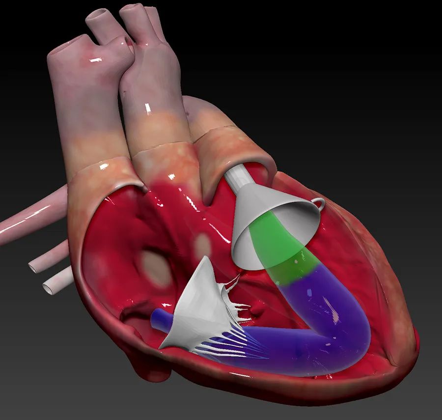 “绿宝书”丨精美图谱，生动形象！换个方式看心脏解剖（2）