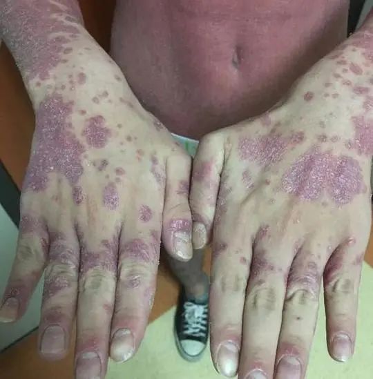 恋爱、结婚，想都不敢想…也有浙江小老板花100万治病：多少钱都行，快把我治好吧