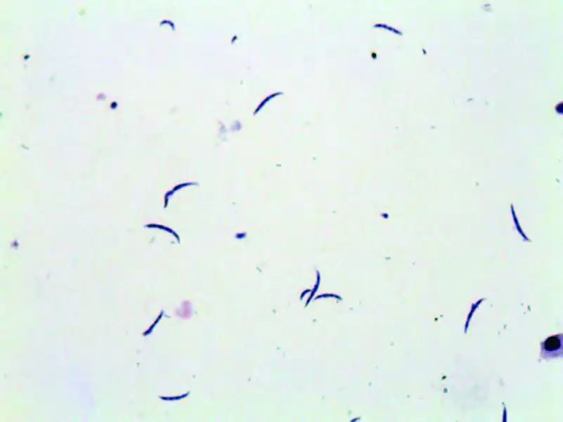 尿液中的有形成分红细胞,尿液中常见的有形成分