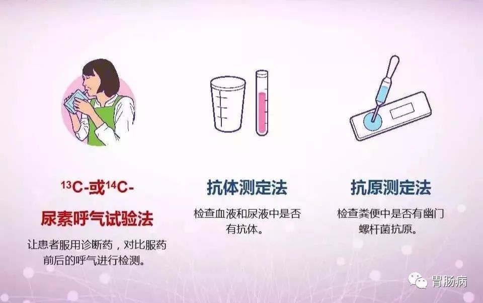 幽门螺杆菌的科普合集,hp幽门螺杆菌症状