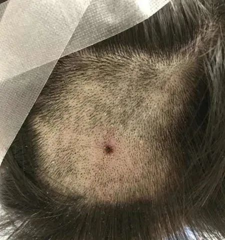 夏季粮食防虫小妙招,夏季防虫小妙招