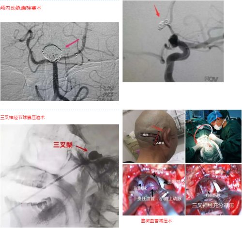 宝鸡高新医院唐宗椿,西安高新医院神经外科专家排名