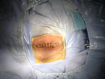 臀部返祖现象,返祖现象长尾巴