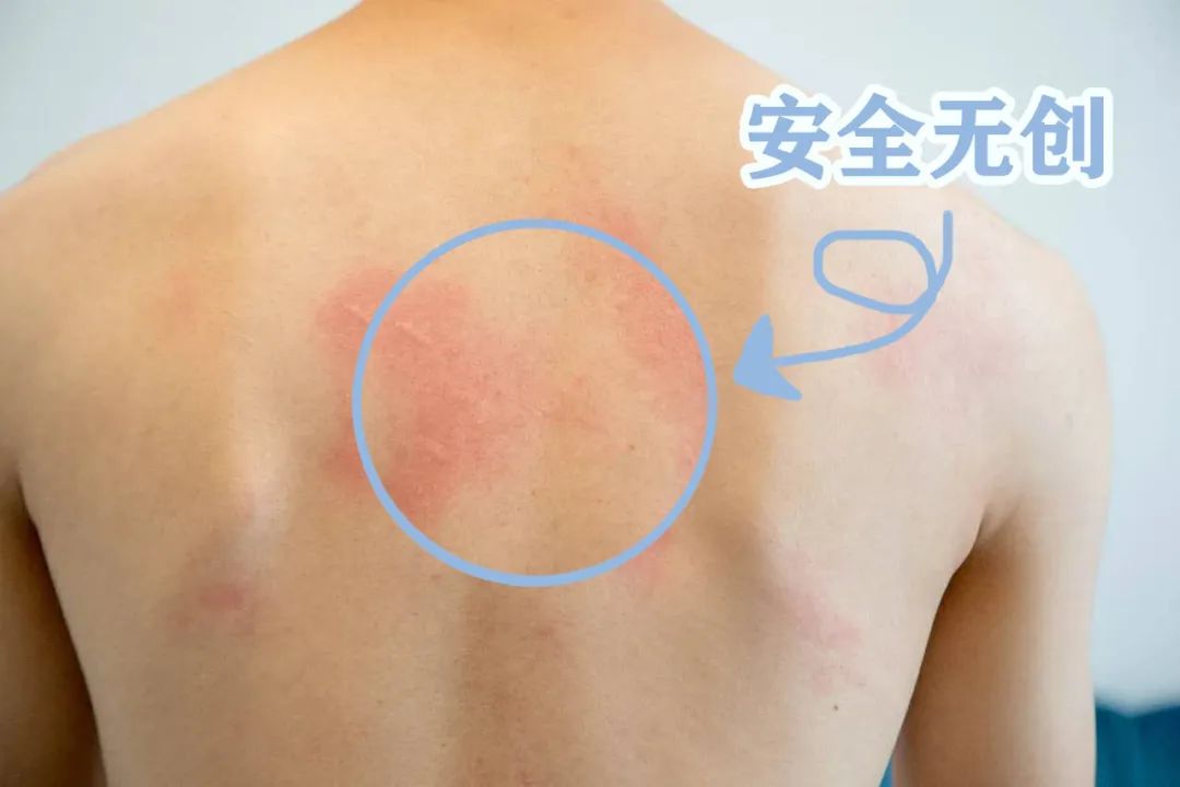 藏不住了！德国黑科技，KO肩颈腰疼痛神器，仅需￥9.9