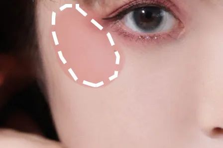 周雨彤祛痘神器,周雨彤的泪沟神器