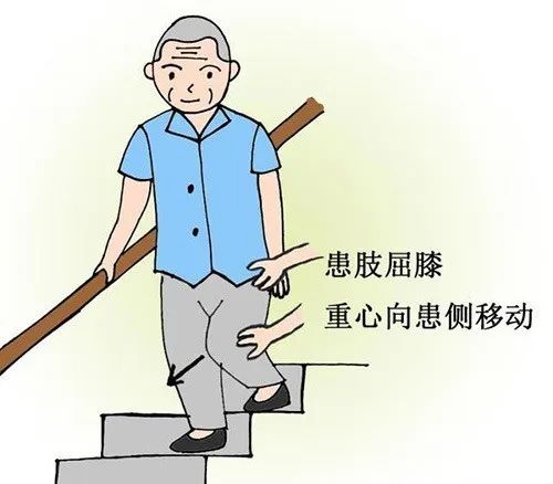 怎样进行康复治疗？《祝您健康》昭通市中医医院陈禹彤医生为您支招