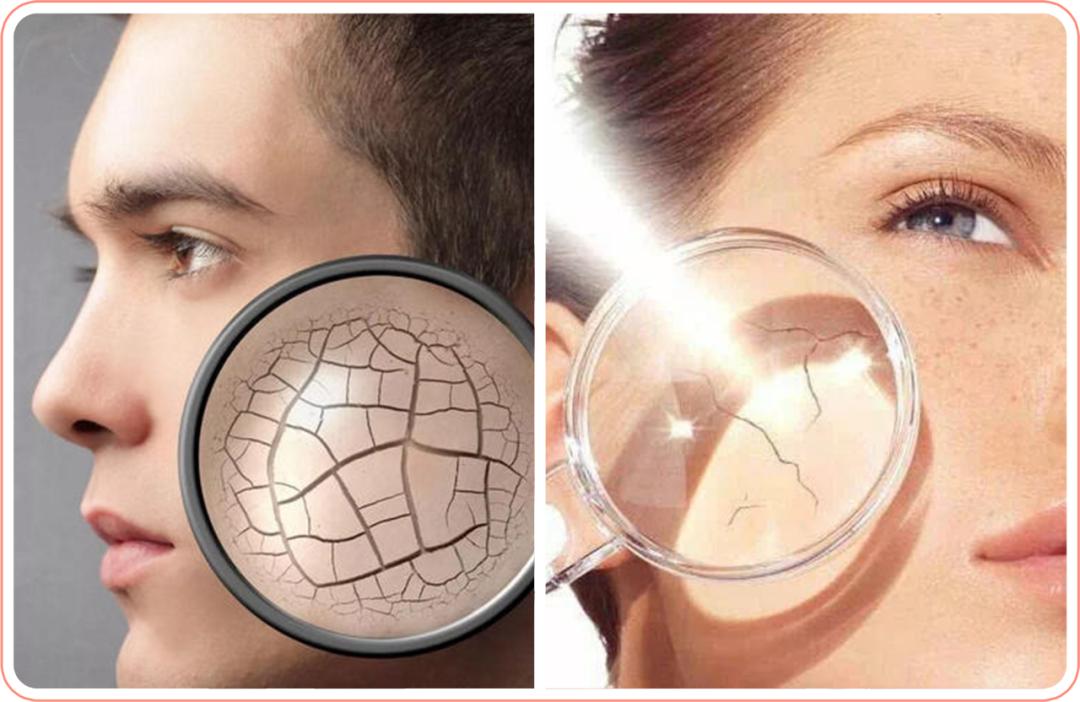 生完孩子皮肤干燥毛孔粗大怎么办,生完孩子后毛孔粗大如何改善