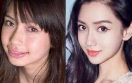 好羡慕别人有一口好牙齿,早日拥有一口整齐更漂亮的牙齿