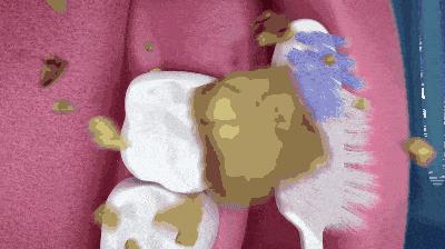 便宜哭了!日本人都在用的变态牙刷,竟然比洗牙还白,牙垢、牙龈出血全解决,嘴巴里脏东西洗出来后,太清爽了