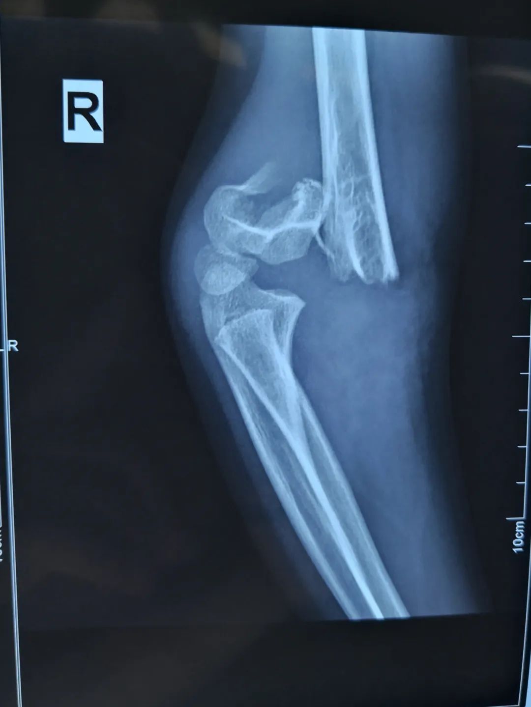 警惕！淄博一医院连续接诊4名孩子，受伤严重！很多家庭都有