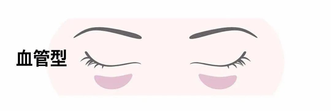 两边黑眼圈程度不一样,黑眼圈的秘密暴露了一个真相