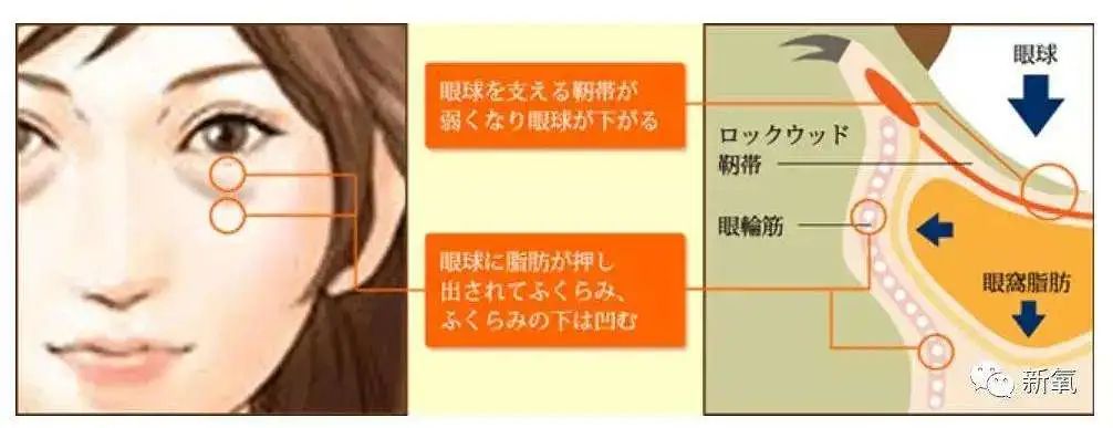 两边黑眼圈程度不一样,黑眼圈的秘密暴露了一个真相