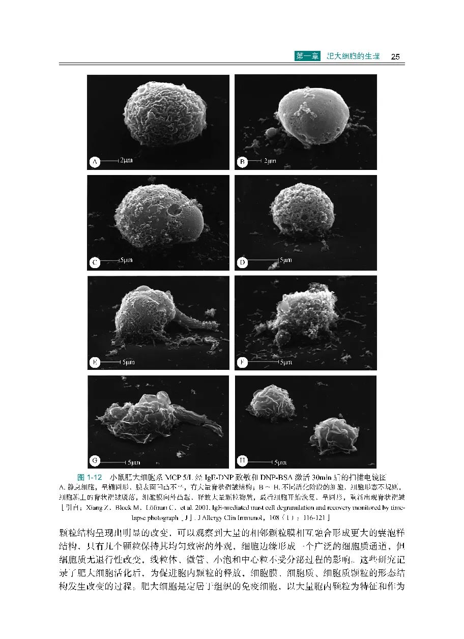 肥大细胞症,肥大细胞产生在哪