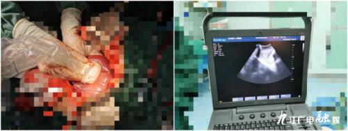 多学科联合诊疗新模式,华西多学科联合会诊