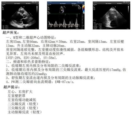 心衰患者睡眠质量差,心衰病人的日常生活现状