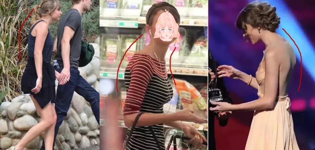 含胸驼背最损气质手把手教你纠正,含胸驼背如何改善提升气质