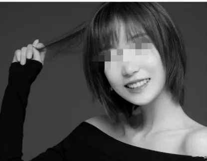 昆明龅牙矫正要多少钱,长沙轻微龅牙矫正要多少钱