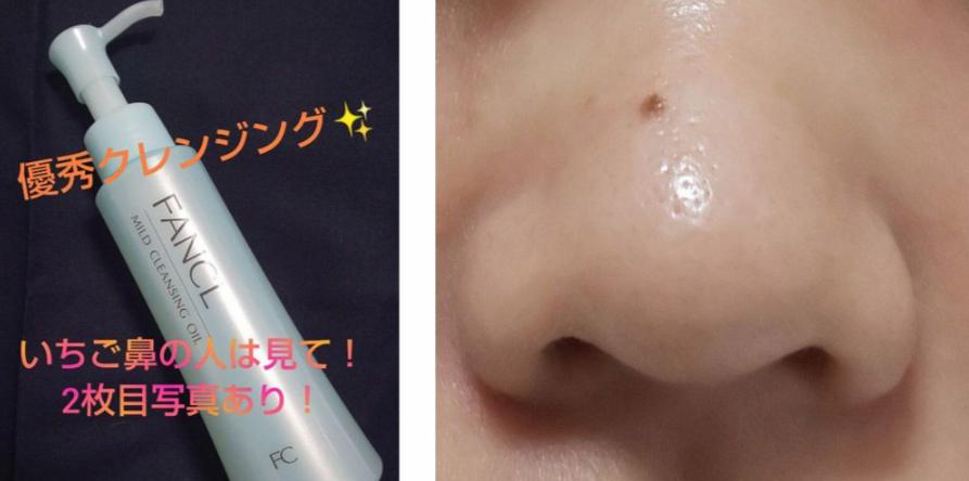 日网疯传超强去黑头「毛孔虐待」组合！3星期去除黑头，超12万点赞获官方认可