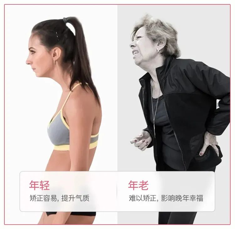 驼背平时自己注意可以改善吗,驼背如何矫正自己的气质