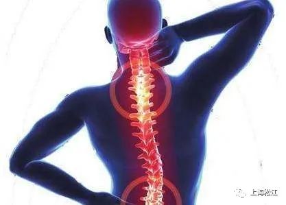 治疗颈椎病的枕头怎么枕最合适,选对枕头预防颈椎病