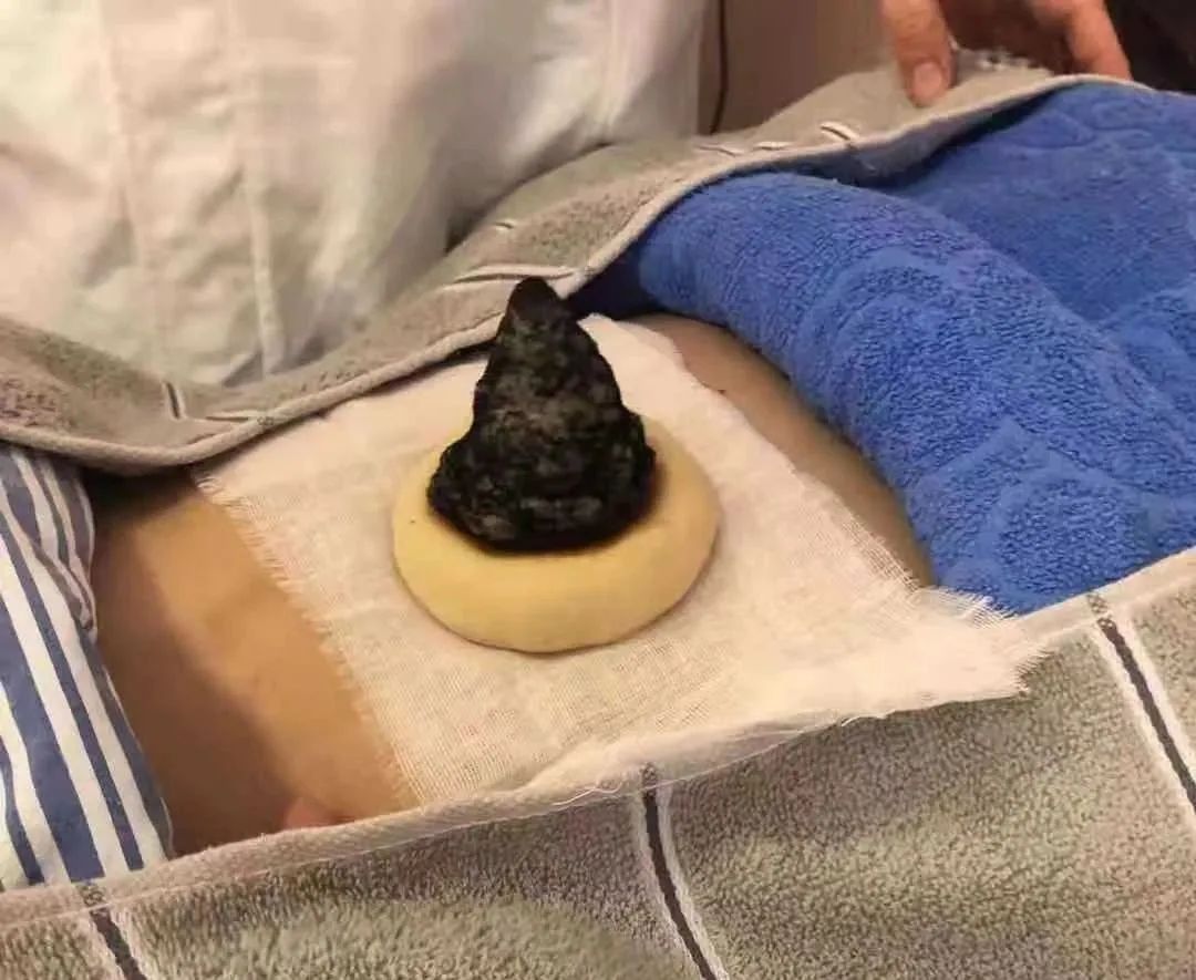 避孕针对女性有哪些影响,自然流产以后用什么避孕好