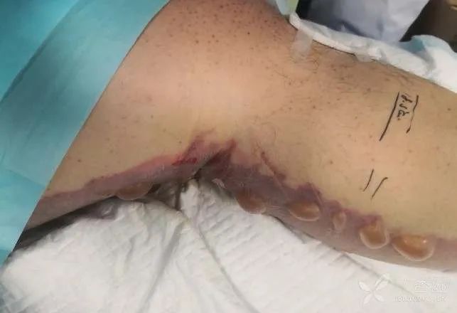 24岁小伙喝下安眠药后续,小伙吃安眠药睡觉