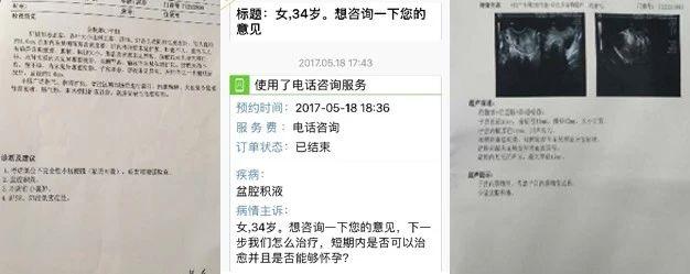 盆腔积液一定要做阴超吗,盆腔积液一定要处理吗